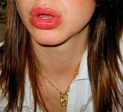 Forr�s: [origo]
