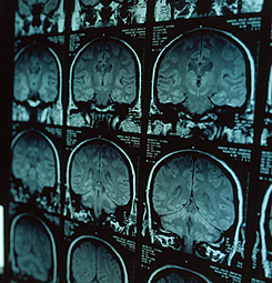 Forrás: AFP Forrás: AFP